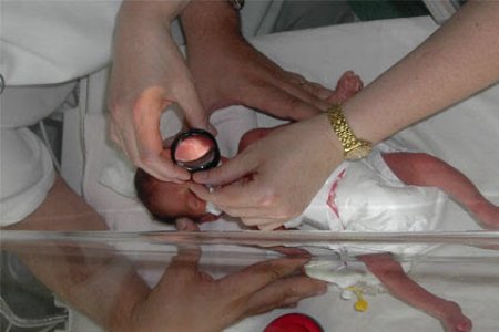 DIAGNOSTICO OFTALMOLOGICO A NEONATALES