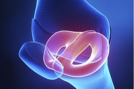 RECOMENDACION POST OPERACION DE MEÑISCOS