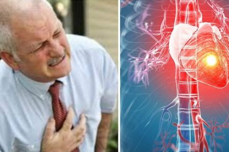 QUE ES UN ATAQUE CARDIACO
