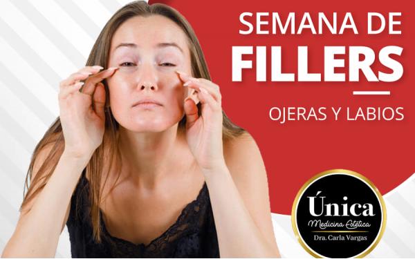 GRAN CAPAÑA DE FILLERS