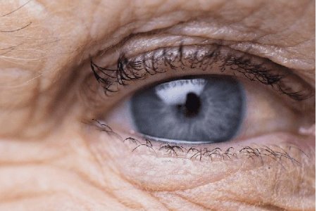 SÍNTOMAS DE LA DEGENERACION MACULAR