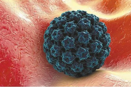 QUE ES HPV Y CUALES SON SUS CAUSAS