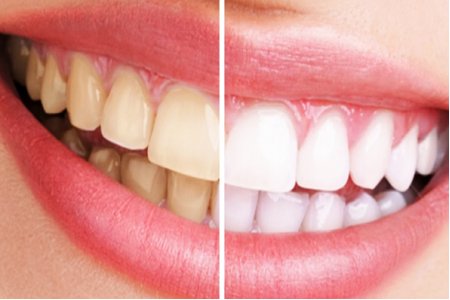 ESTETICA DENTAL