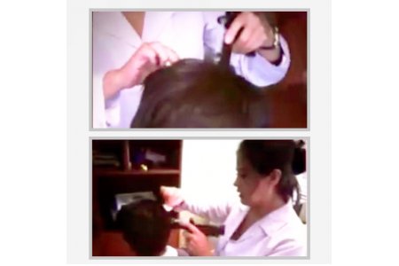 Intradermoterapia facial, capilar y corporal