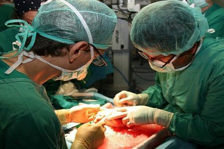TRANSPLANTE RENAL