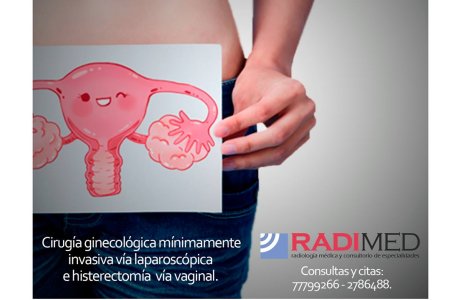 CIRUGIA GINECOLOGICA LAPAROSCOPICA