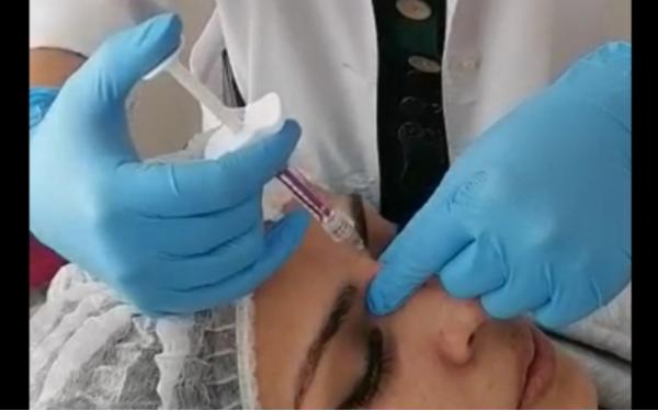 ARMONIZACION FACIAL