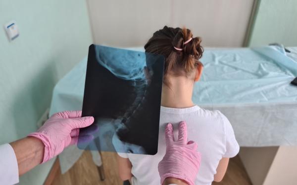 ESCOLIOSIS