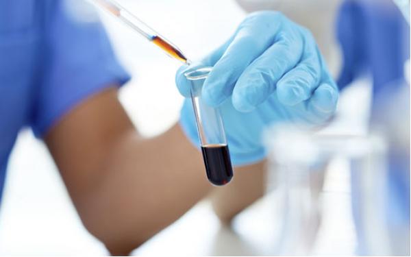 Naturopathic Tests