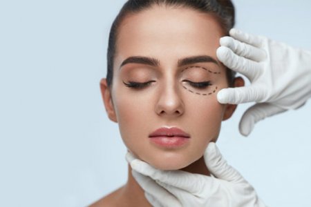 BLEFAROPLASTIA 