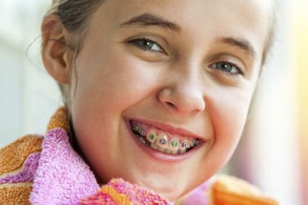APARATO DENTAL - ORTODONCIA