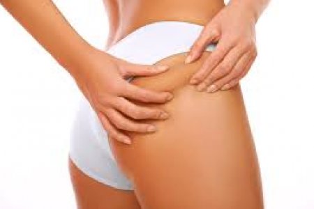 CELULITIS