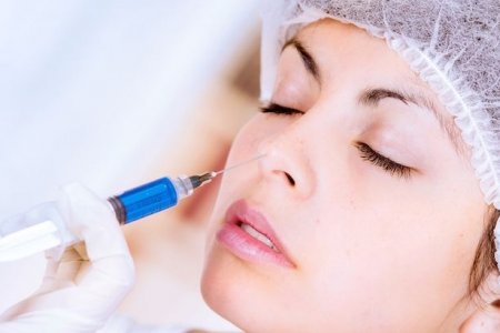 BIOPLASTÍA DE NARIZ (GEL HIAlURÓNICO)