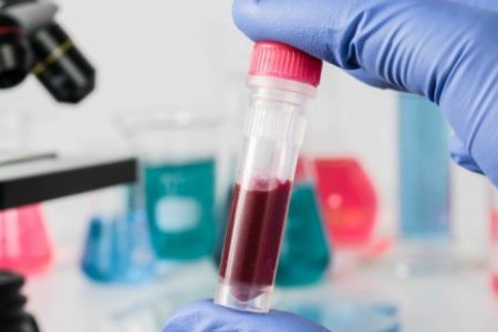 HEMATOLOGÍA