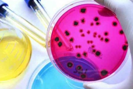 MICROBIOLOGIA