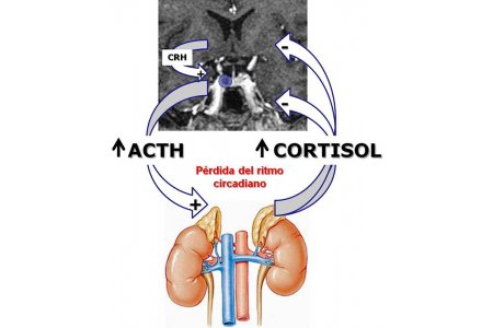 ACTH-CORTISOL