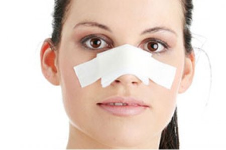 RINOPLASTIA CIRUGÍA DE NARIZ