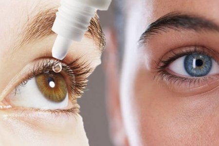 GLAUCOMA