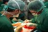 TRANSPLANTE RENAL