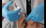 ARMONIZACION FACIAL