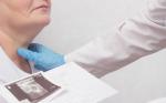 LA ENDOCRINOLOGIA