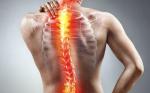 ESCOLIOSIS NEUROMUSCULAR