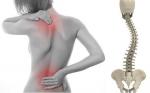 ESCOLIOSIS CONGÉNITA