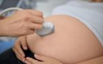 Control Prenatal
