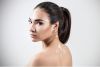 VITILIGO