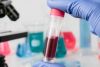 HEMATOLOGÍA