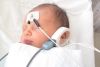 SCREENING AUDITIVO NEONATAL