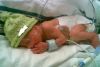 NEONATOLOGIA